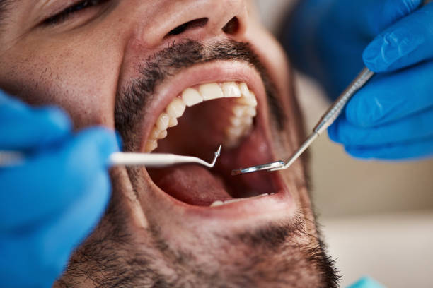 Best Emergency Dental Care for Abscessed Tooth in Federalsburg, MD